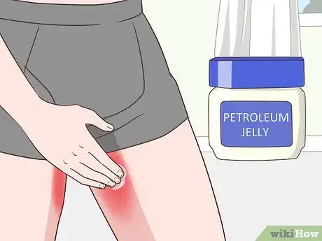 Image titled Prevent Chafing Between Your Legs Step 4