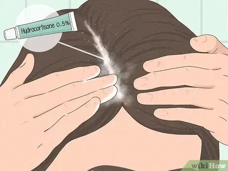 Image titled Prevent and Treat Dandruff Step 3