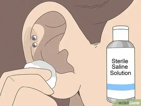 Image titled Pierce Your Own Cartilage Step 12