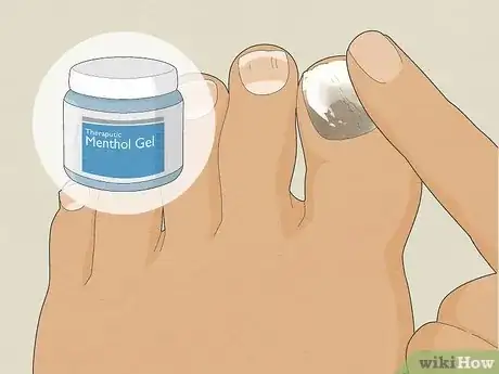 Image titled Treat Toe Nail Fungus Step 7