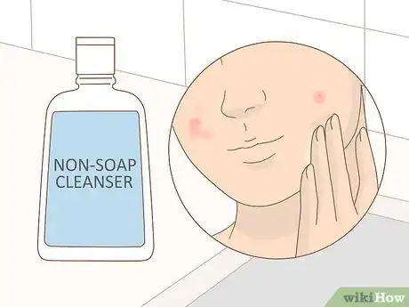 Image titled Take Care of Your Skin While on Accutane Step 4