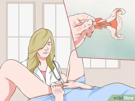 Image titled Get an IUD Taken Out Step 7