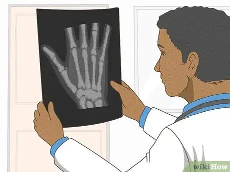 Image titled Diagnose a Broken Thumb Step 11
