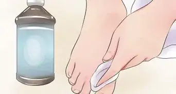 Prevent Smelly Feet