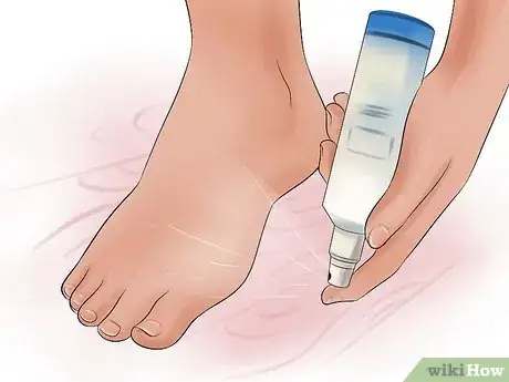 Image titled Prevent Smelly Feet Step 6