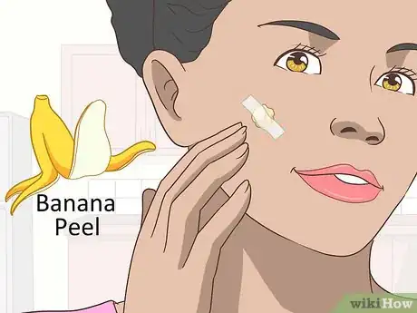 Image titled Remove Facial Warts Step 5