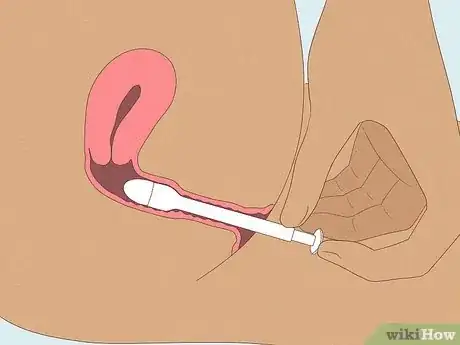 Image titled Use Spermicides Step 5