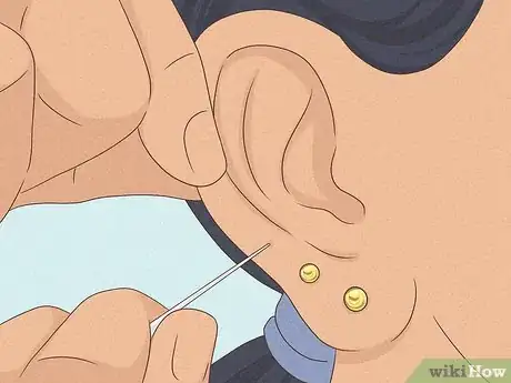 Image titled Is It Safe to Pierce Your Own Cartilage Step 1