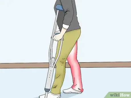 Image titled Make Your Crutches More Comfortable Step 7