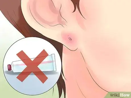 Image titled Take Care of Pierced Ears Step 13
