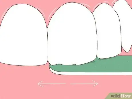 Image titled File Down a Sharp Tooth Step 10