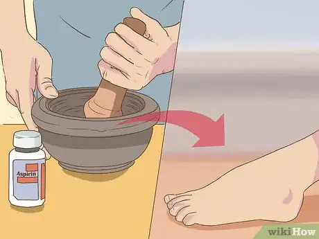 Image titled Remove Dead Skin from Feet Step 3
