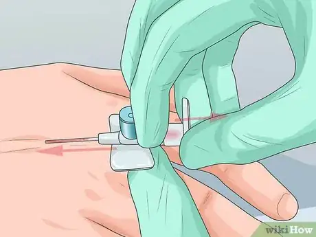 Image titled Insert a Cannula Step 9