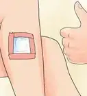 Remove a Band Aid Painlessly
