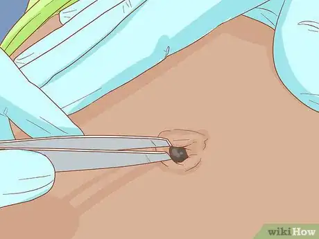 Image titled Clean Your Belly Button Step 10