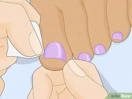 Image titled Have Pretty Toenails Step 14