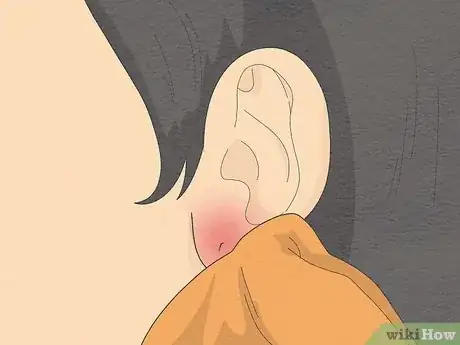 Image titled Clean Your Ear Piercing Step 10