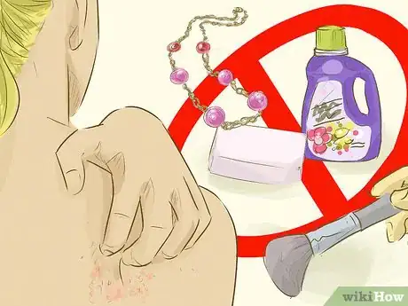 Image titled Stop Itching Step 11