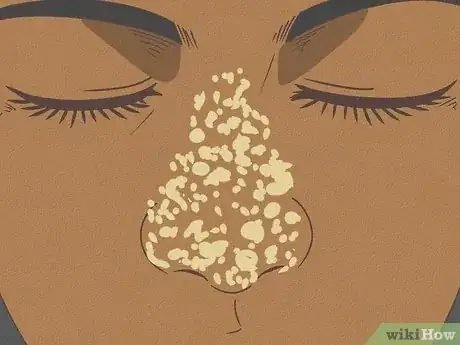 Image titled Clean Nose Pores Step 1