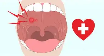 Get Rid of Mouth Blisters