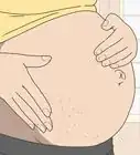 Minimize Stretch Marks During Pregnancy