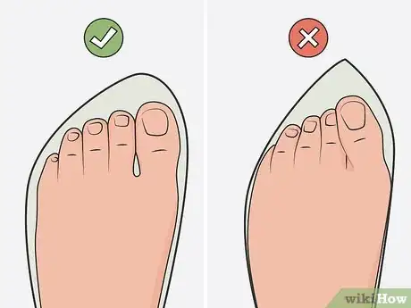 Image titled Heal a Bruised Toenail Quickly Step 17