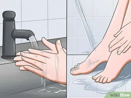 Image titled Prevent Nail Fungus Step 1
