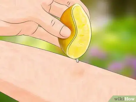 Image titled Get Bug Bites to Stop Itching Step 4