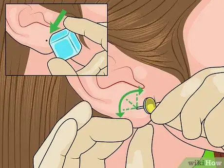 Image titled Reopen a Partially Closed Ear Piercing Hole Step 10