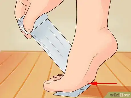 Image titled Wrap an Ankle Step 1