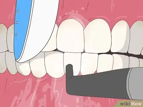 Image titled Stop Itchy Gums Step 16
