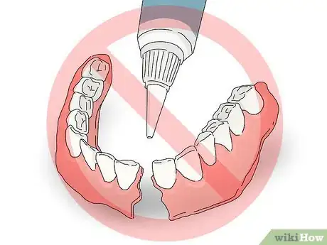 Image titled Buy Dentures Step 10