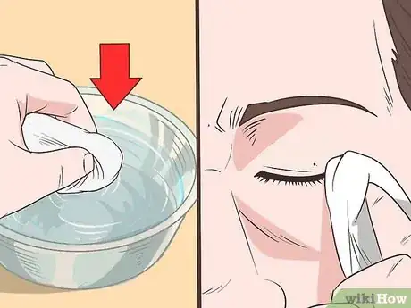 Image titled Clean Eyelids Step 2