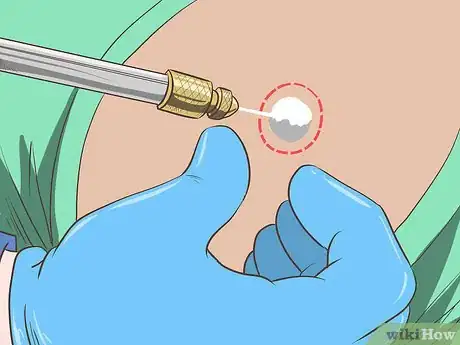 Image titled Remove Moles Without Surgery Step 5