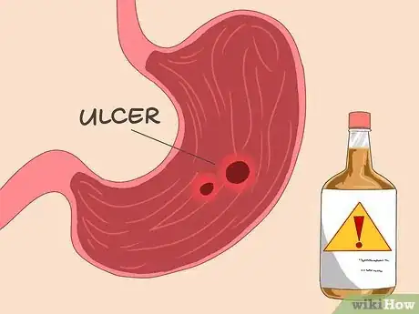 Image titled Ease Peptic Ulcers Using Bananas Step 14