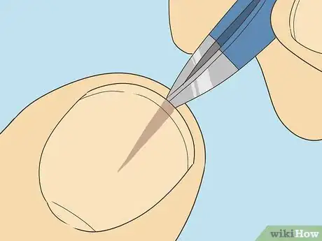 Image titled Remove a Splinter Under Your Fingernail Step 3