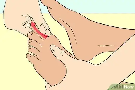 Image titled Give a Foot Massage Step 5