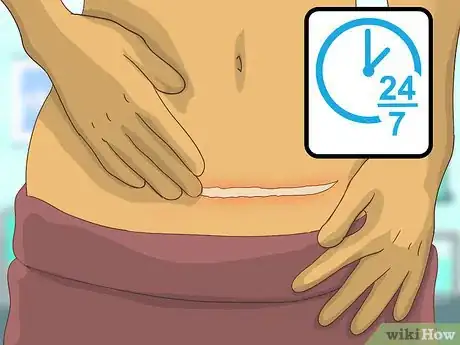 Image titled Care for Your C Section Scar Step 12