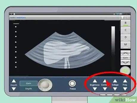 Image titled Use an Ultrasound Transducer Step 6