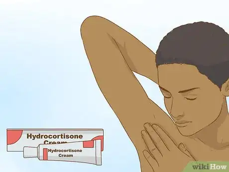 Image titled Get Rid of a Zit on Your Armpit Step 12