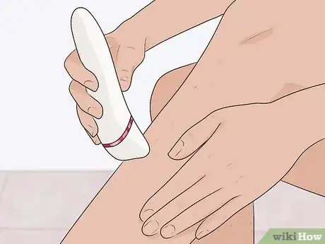 Image titled Epilate Legs Step 12