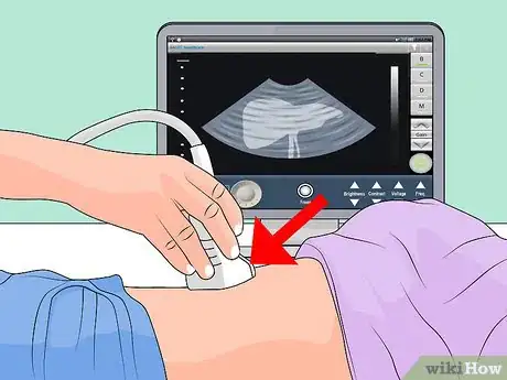 Image titled Use an Ultrasound Transducer Step 5