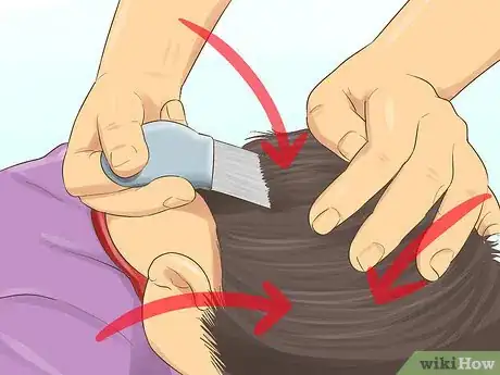 Image titled Check a Child's Hair for Lice Step 10