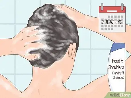 Image titled Prevent and Treat Dandruff Step 1