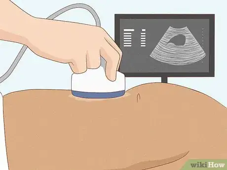 Image titled Get Rid of Gallstones Step 10