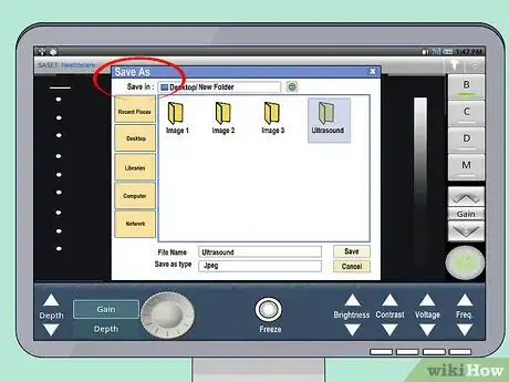 Image titled Use an Ultrasound Transducer Step 8