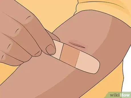 Image titled Test the Effectiveness of a Bandage Step 11