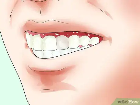 Image titled Know if You Have an Infected Tooth Step 5