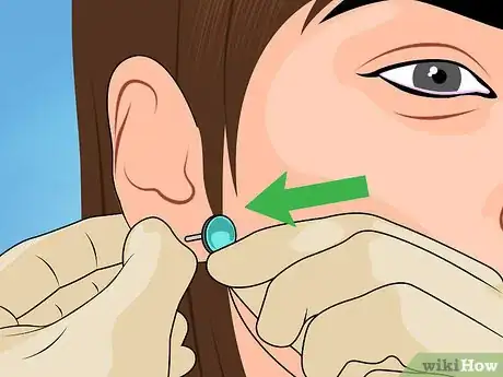 Image titled Reopen a Partially Closed Ear Piercing Hole Step 12