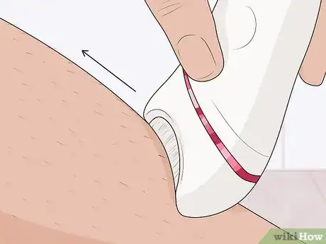 Image titled Epilate Legs Step 11